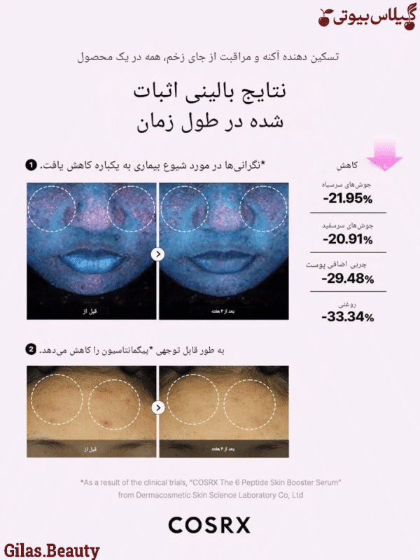 6 پپتاید قدرتمند در خرید سرم ضد چروک کوزارکس اصل