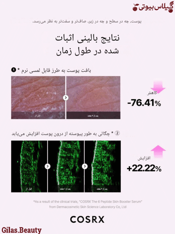 خرید سرم بوستر تقویت کننده 6 پپتاید کوزارکس همراه با محصولات مکمل